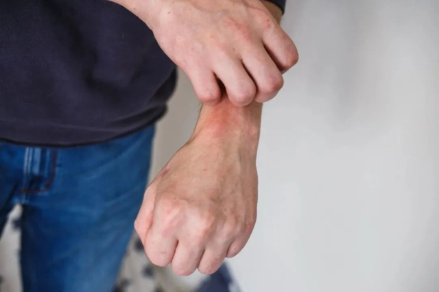 特禀体质中医养生知识